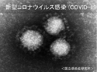 新型コロナウイルスの拡大写真